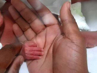 Prematuro na Neo Natal de Alegrete