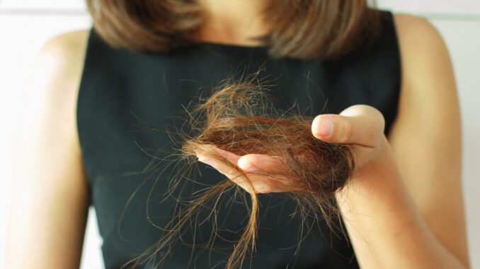Queda de cabelo: quais as causas e quando deixa de ser normal Queda de cabelo: quais as causas e quando deixa de ser normal