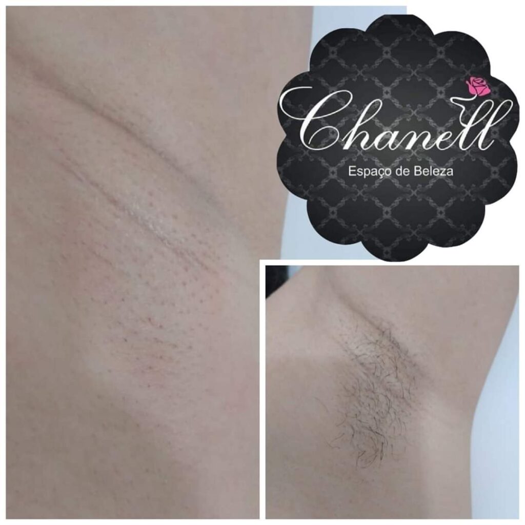 Conheça Chanell Espaço da Beleza e mude seu conceito sobre depilação