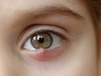 Terçol: causas, sintomas e como tratar