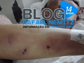 Assisense sobrevive após brutais agressões de outra mulher